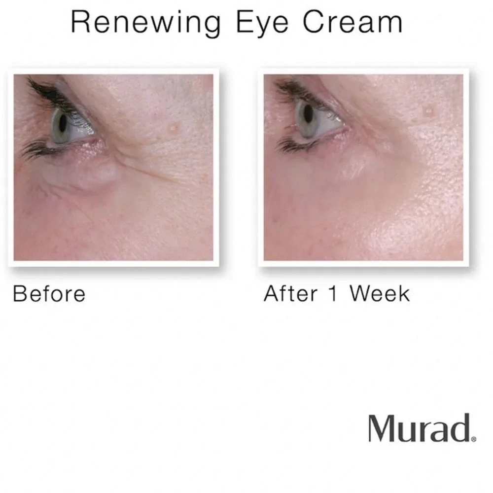 NEW Murad Resurgence Renewing Eye Cream 0.5 fl oz Moisturize Dark Circle‎